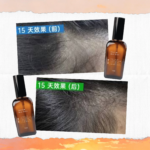 COFORYOU - PROMO TRIO PACK HAIR TONIC - 3支 - Image 2